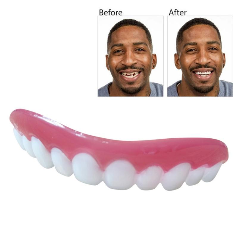 Perfect Smile Veneers Dub In Stock For Correction of Teeth For Bad Teeth Give You Perfect Smile Veneers mouth support